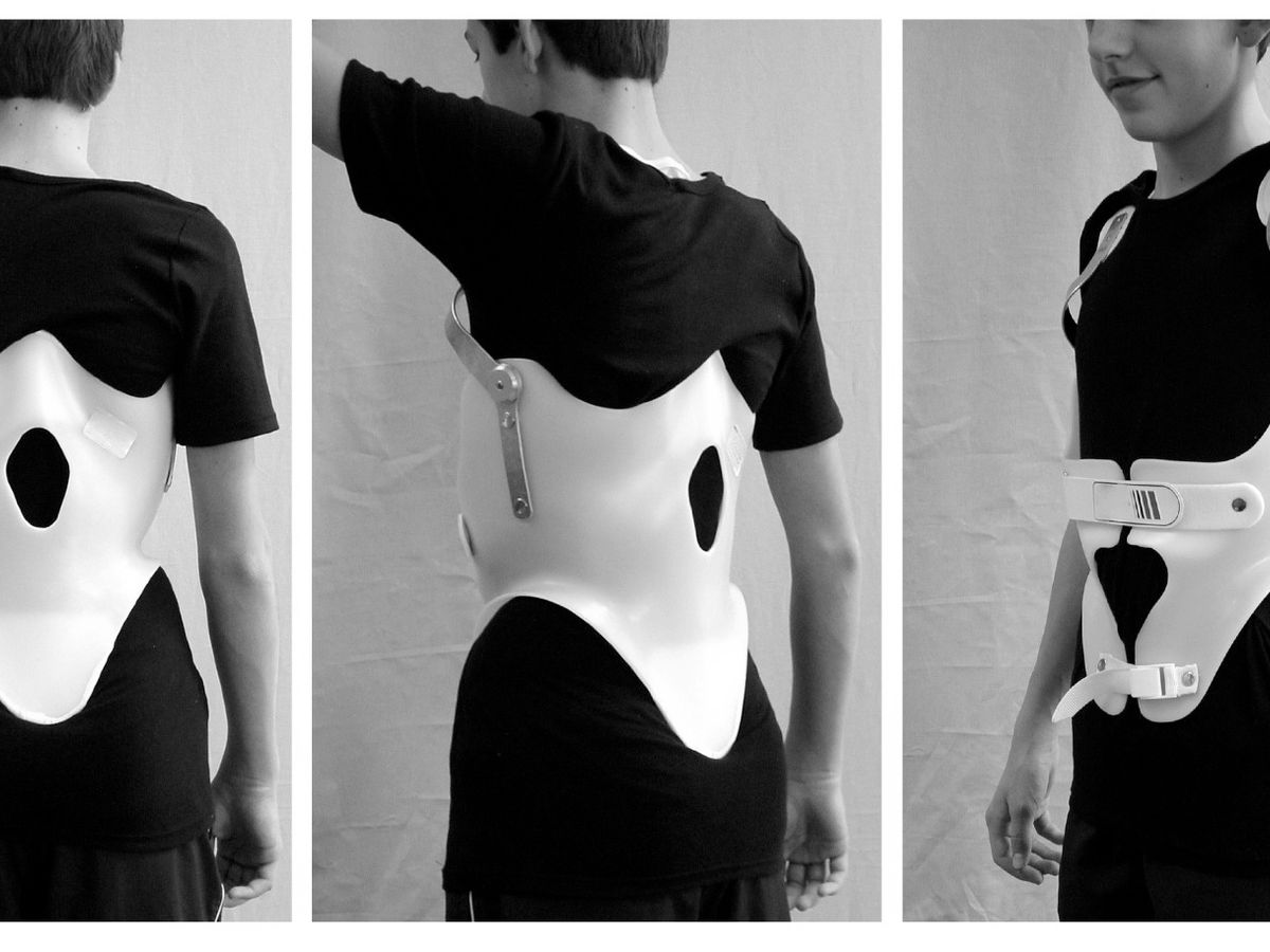 physical therapy for scoliosis