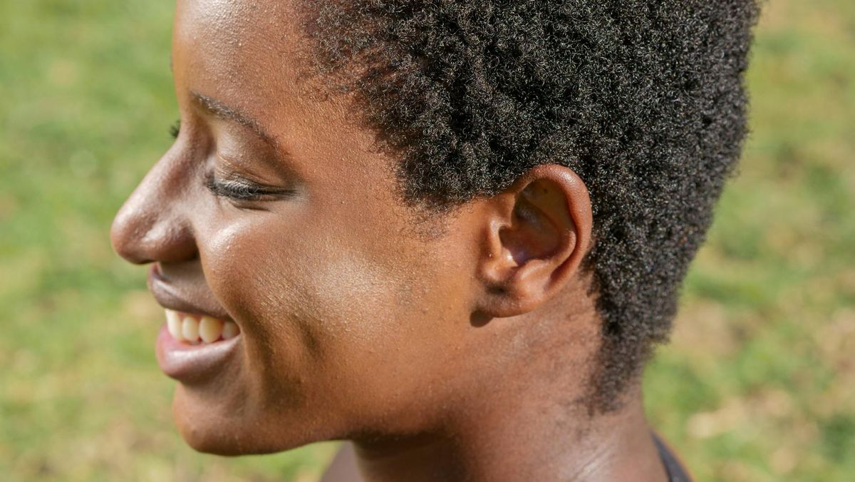 The Adolescent Years: Acne's Prime Time