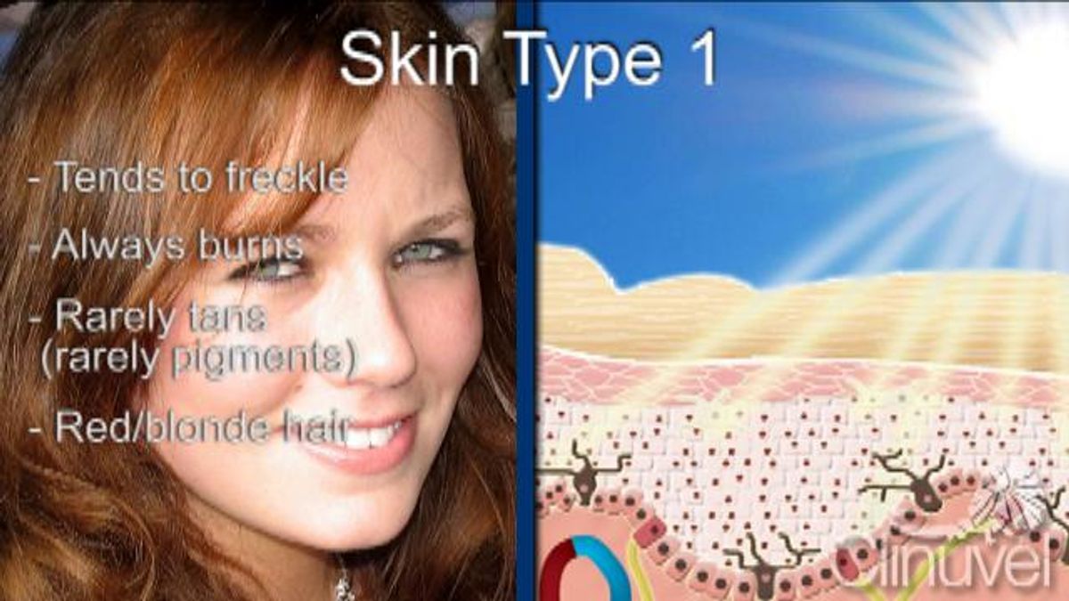 Understanding Mixed Skin