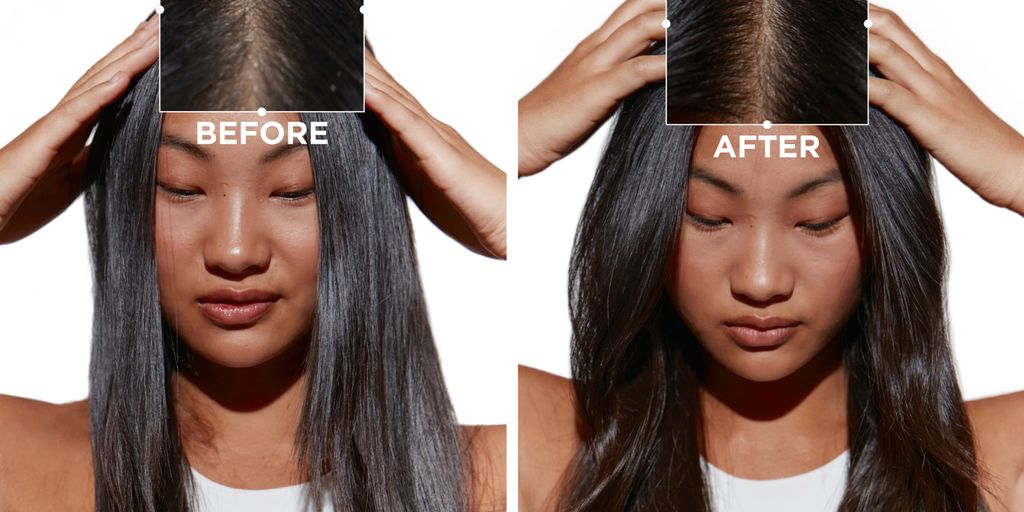 Before and after comparison of hair treatment results on a person.