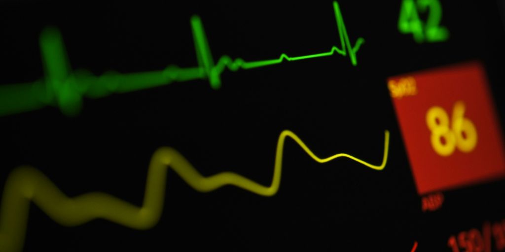 a close up of a monitor screen with a heart beat