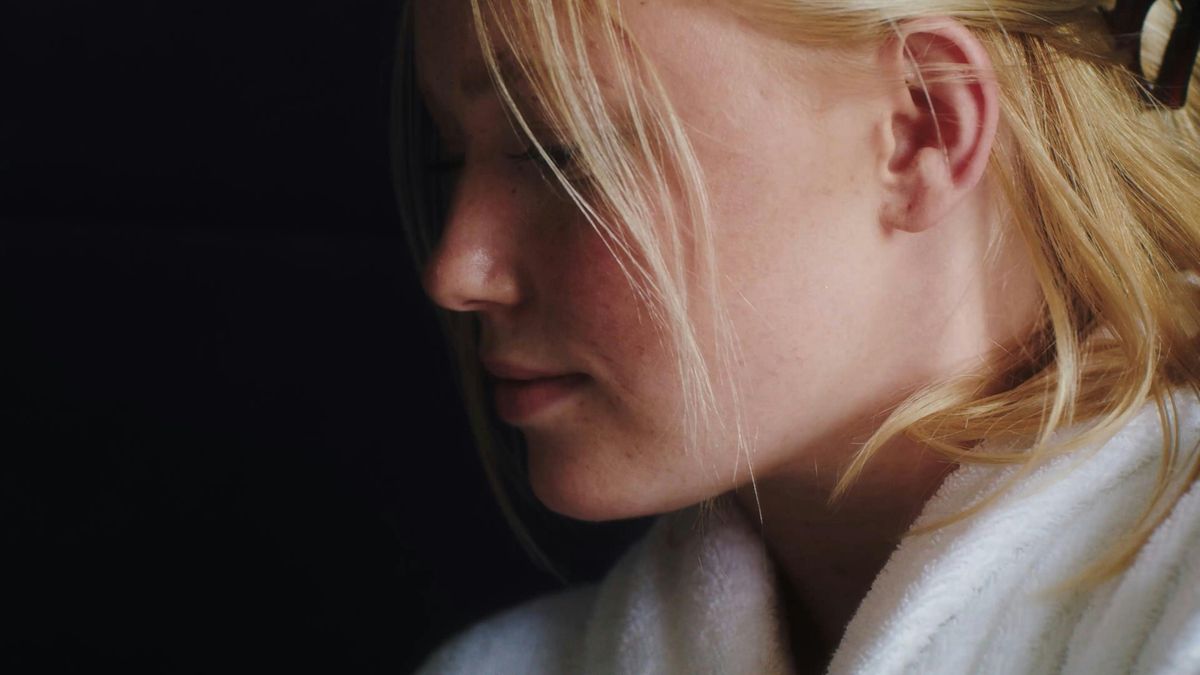 Transitioning into Adulthood: Chronic Acne and Healthcare