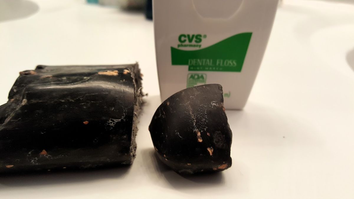 Alternative Hilfsmittel zur Zahnzwischenraumreinigung