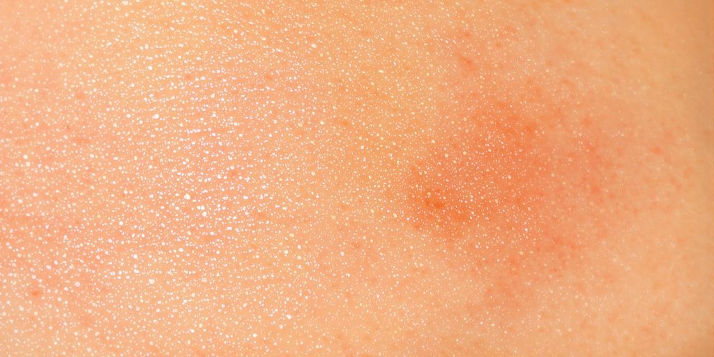 Skin under UV light showing signs of tanning and damage.