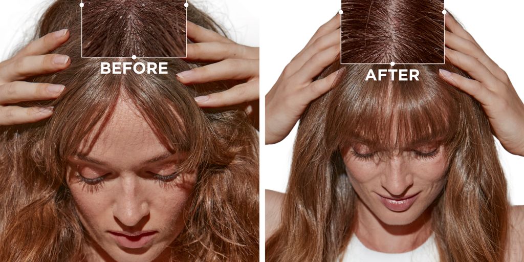 Before and after comparison of hair treatment on a person.
