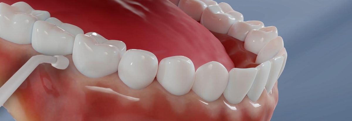 Die Bedeutung der Zahnseide für die Mundhygiene