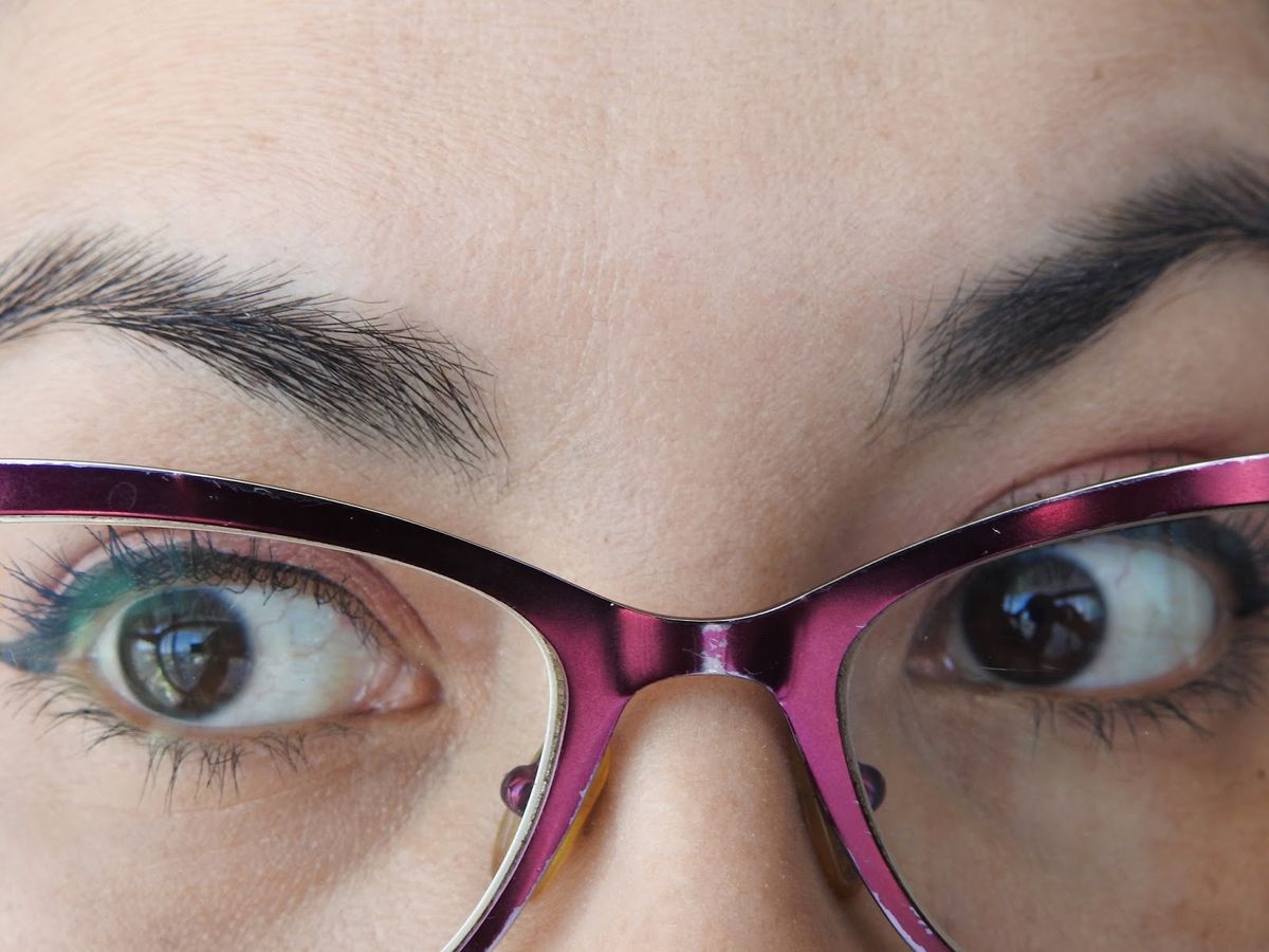 The Reproductive Years: Acne and Fertility