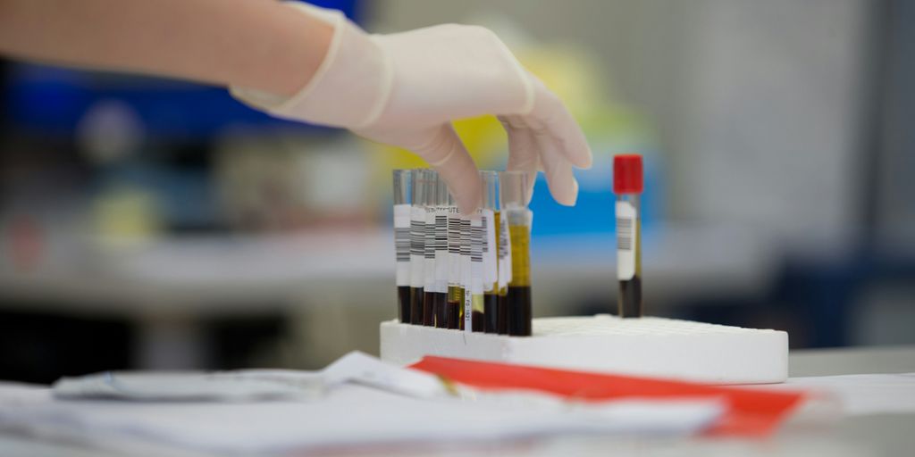 a gloved hand holding a test tube filled with blood